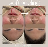 ヴェルソー(Verseau)