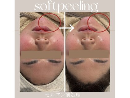 ヴェルソー(Verseau)の写真