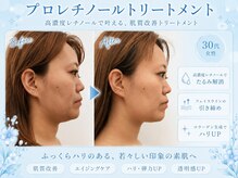 アールフェイスバランスの雰囲気（お肌を健康に導くフェイシャル♪うるうる保湿感あふれる肌へ！）