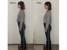 コルミチョン サロン(骨美整 salon)/姿勢　Before・After 