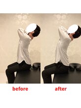 ナオル整体 福岡香椎院(NAORU整体)/30代男性施術事例【猫背】