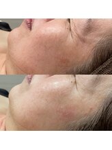 ギャラクシービューティー(galaxy beauty)/