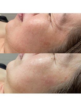 ギャラクシービューティー(galaxy beauty)/