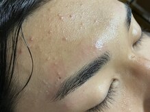 シェービングアンドエステティックエミュ (shaving & estetic emu)