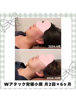 ウナ デ リンゴル 恵比寿店(UNA de Ringol)/当店1番人気小顔メニュー¥13500