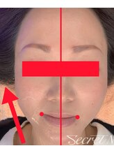 マイルーム(my room)/サーマルフラクショナル