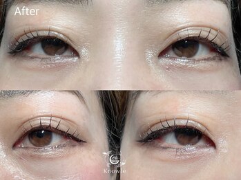 ノウル(Knowle)/マスカラパーマ