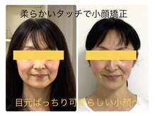 サロン ガト(Salon Gato)の雰囲気（2ヶ月で印象が変わる小顔矯正! 愛らしく艶やかな小顔へ導きます）