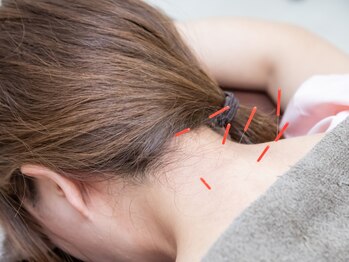 おいけ接骨院 太田藪塚院/鍼灸施術