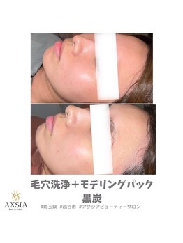 アクシア ビューティー サロン(AXSIA)/【毛穴洗浄＋モデリングパック】