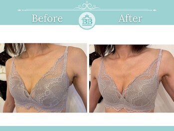 美人バスト 新潟店/ 【バストアップ★育乳】症例