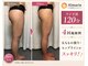 アロマリエ(al malie)の写真/太もも・ヒップラインを本気で変えたい方へ◆ラジオ波専門サロン