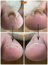 一宮巻き爪センター/巻き爪