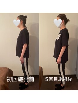 リクゥ(ReQuu)/店内のビフォーアフター 超短波