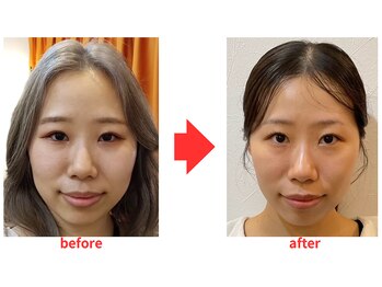 ブプラ 小倉店(BUPURA)/