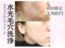 アルバ 広島店(ALBA)