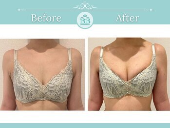 美人バスト 新潟店/ 【バストアップ★育乳】症例