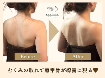 ラフリー 前橋院(RUFFREE)/むくみフリーで背中美人【前橋】