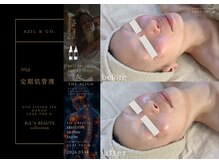 オーヴォ リビングスパ アネックス マノン(OVO LIVING SPA annex MANON)/【施術事例】定期肌管理