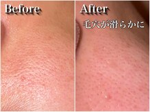 ミムーの雰囲気（肌質改善で毎日のお化粧ノリが良くなりモチベーションUP◎）