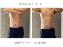 ユー(U)/筋膜リリース