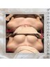【デコルテそげ胸コース】デコルテからふんわりバストアップ35000円→6800円