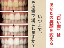 ホワイトニングセンター 長野駅前店