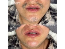 サロンロン 横浜関内(SALON RON)の雰囲気（気になる髭も美容電気脱毛でスッキリ！デザイ髭・白髪髭も可能！）