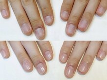 アメリアンドカシェット(Amelie&Cachette)/深爪＊自爪育成【1回目】