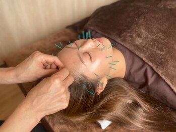 リハリ 本町院(///Rehari)の写真/小顔も美肌も手に入れたい方におすすめ◎《電気美容鍼》感動の結果にファン急増中！サブスクも人気★