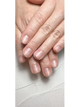 スマイルニコ(smile nico)/深爪矯正　自爪育成