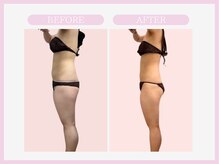 スリムライン 弘前店(The Slim Line)/before→after