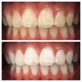 ミモアサロン 岡崎店(mimoaサロン)