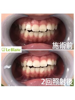 ルブラン 奈良店(Le Blanc)/おかえりなさいませ(^ ^)