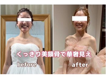 アミクール エステティックサロン(amicoeur)/ブライダルエステ