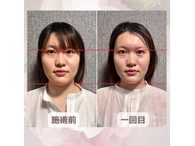 エレーニ 麻布十番(ELENI)の雰囲気（小顔美ボディ整体【麻布十番／小顔／コルギ／頭蓋骨矯正】）