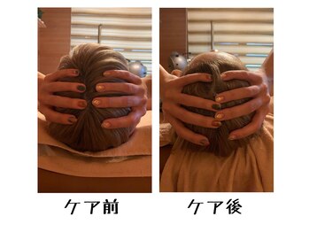 カーサ(ca-sa)/脳美容ケア(before・after)
