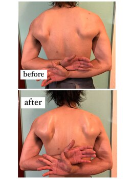 ルルマル(lulumalu)/天使の羽肩甲骨はがし