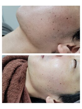 エスボーテ(sbeaute)/ヌクレールフェイシャルワックス