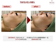 ブリエ/美容皮膚科監修エステ美顔導入器