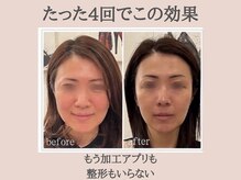 ラウレア(Laule'a)