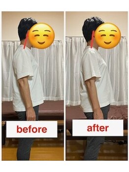にこ。/整体による姿勢の変化