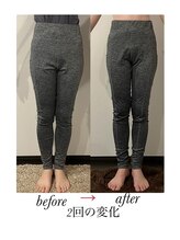 マージェ(magie)/新技術☆骨盤美子宮デザイン