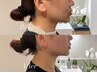 【魅力的なフェイスライン★短時間でも効果実感！】小顔矯正30分 ¥3,300