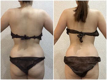 美容整体ウェリナ あま甚目寺院/小顔矯正/骨盤矯正/美脚サロン