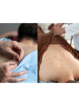 メンズにオススメのサロン