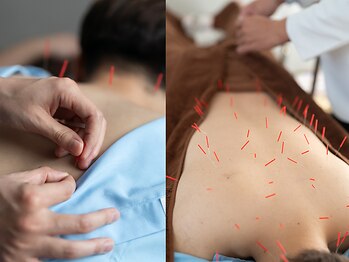 リケア 西新宿鍼灸院(reCare)の写真/学生から社会人までが集う新宿の鍼灸院。勉強や仕事の疲れを鍼灸で改善してパフォーマンスアップ!!