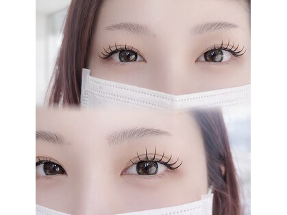 フランク(f)の写真