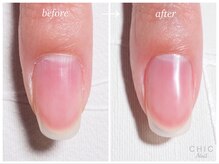 シックネイル(CHIC nail)/好感度Upの美ナチュラル爪☆