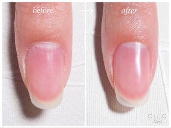 シックネイル(CHIC nail)/好感度Upの美ナチュラル爪☆